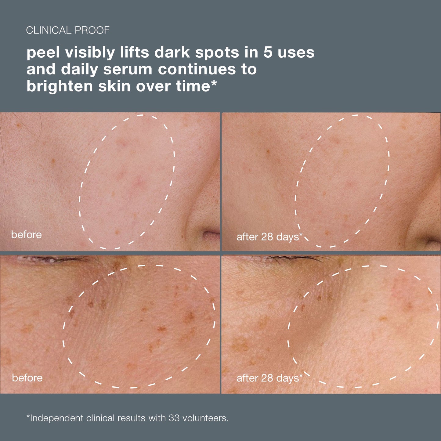 powerbright dark spot system clinical claim 